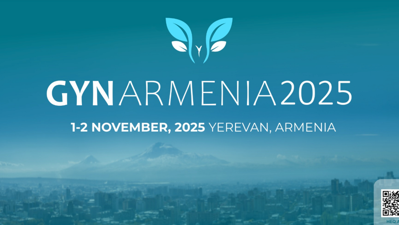 event cover